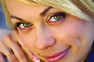 Botox bij Medi-Mooi Botox bij Medi-Mooi