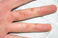 Handwratten